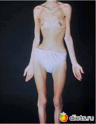 Худейте, но не переусердствуйте!