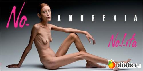 анорексия
