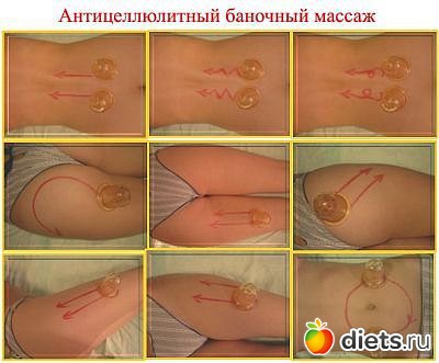 антицелюлитный массаж