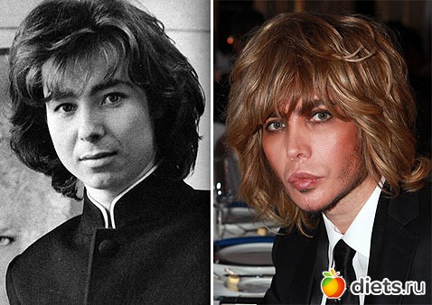 Жертвы пластической хирургии