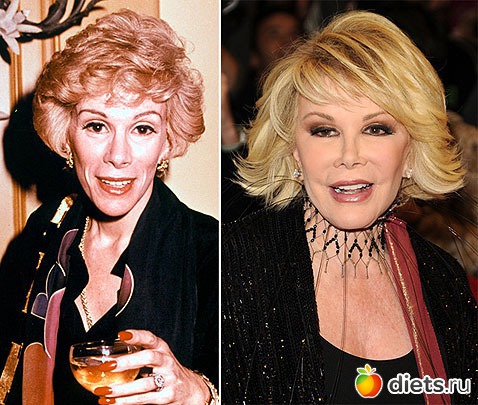 Жертвы пластической хирургии