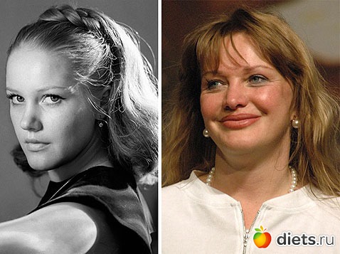 Жертвы пластической хирургии