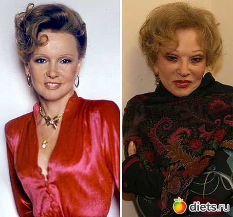 Жертвы пластической хирургии