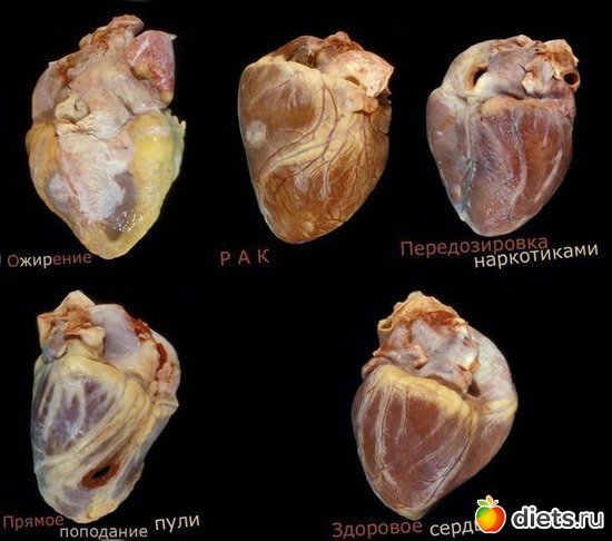 1 ����: ��������