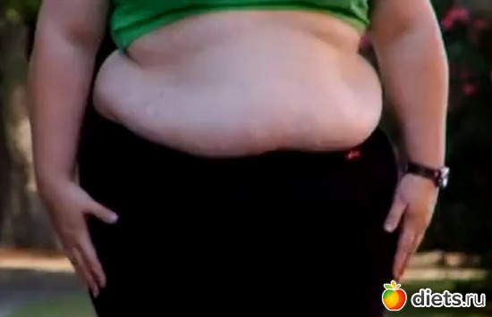 На нее было просто страшно смотреть, альбом: Рекордное похудение