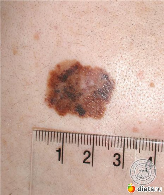 1 ����: �������� ��������