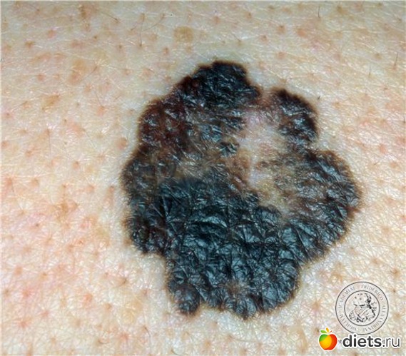 2 ����: �������� ��������