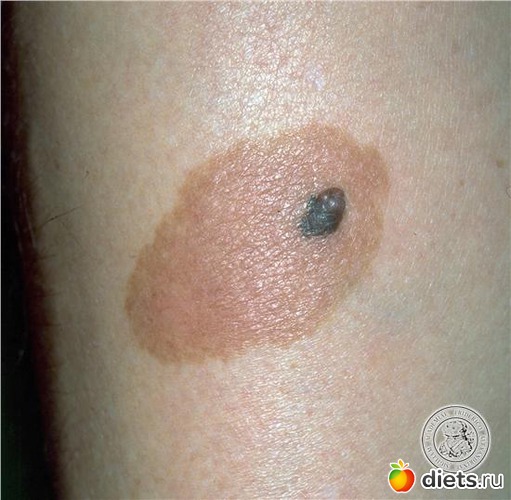 3 ����: �������� ��������