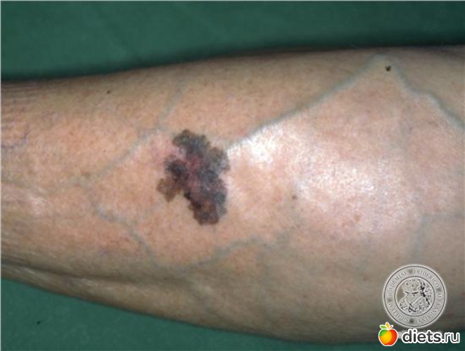 4 ����: �������� ��������