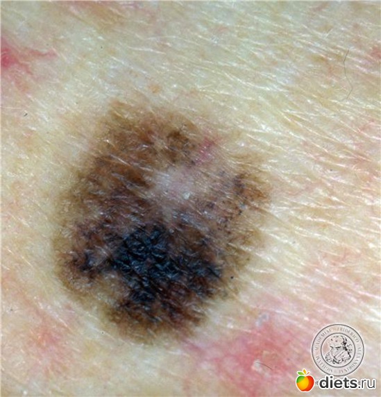 5 ����: �������� ��������