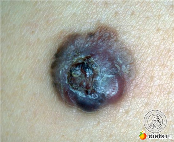 6 ����: �������� ��������