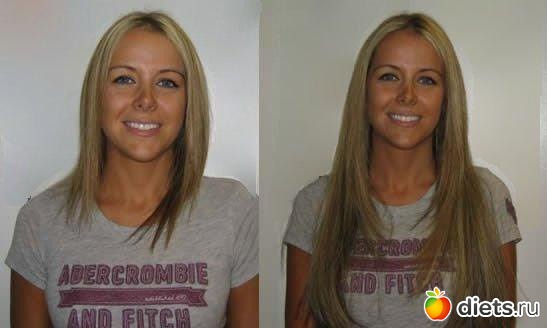 Волосы роскошные......