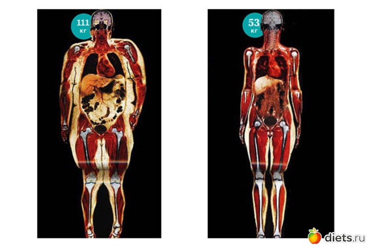 14 ����: ���������