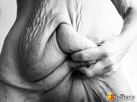 115 ����: ���������