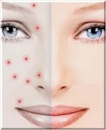 Проблемная кожа