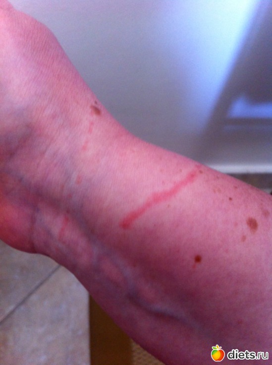 62 фото: Халкидики 2013