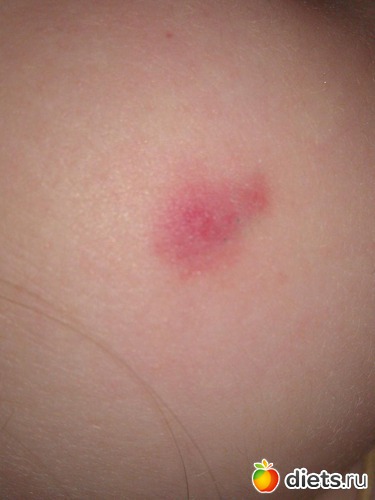 1 ����: ��������?