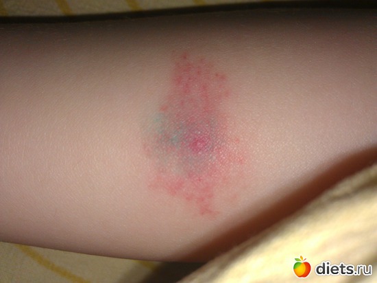 2 ����: ��������?