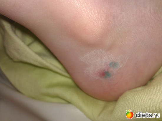 3 ����: ��������?