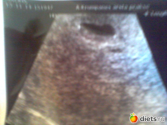 1 ����: ������