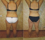 результат 2-х недель