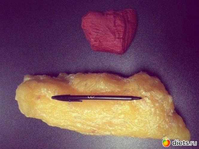 1,5 �� ���� � 1,5 �� �����, ������: ���������� �����