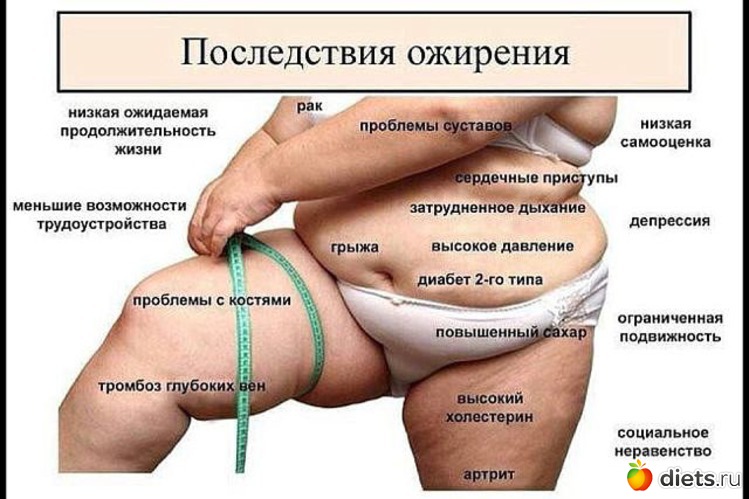 29 ����: ���������