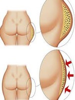 небольшие результаты (12дней из 90), и про жир