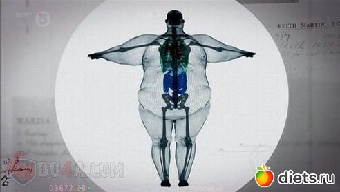 Воть как-то так))