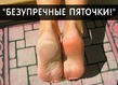 Пяточки.