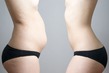Самые распространенные мифы о потере веса