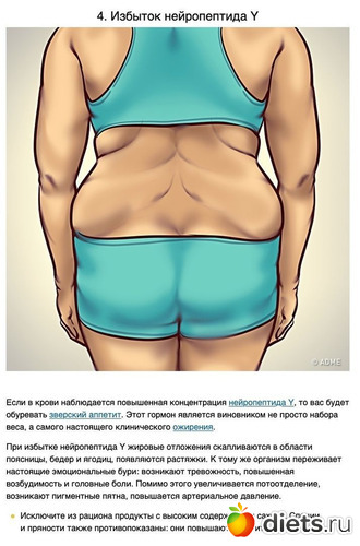 4 фото: Избыточный вес и гормоны