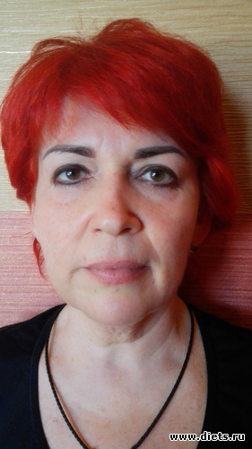 3 фото: После