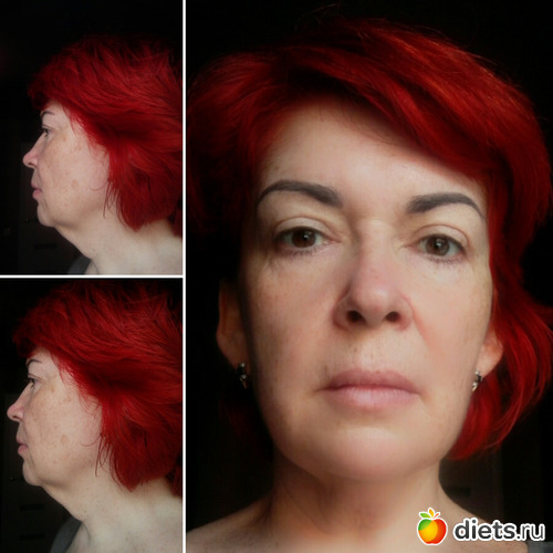 7 фото: После